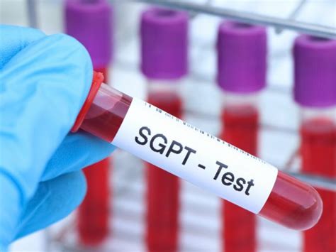 normal range danger level of sgpt and sgot